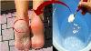 In Just 3 Minutes Get Rid Of Cracked Heels Permanently Magical Cracked Heels Home Remedy
